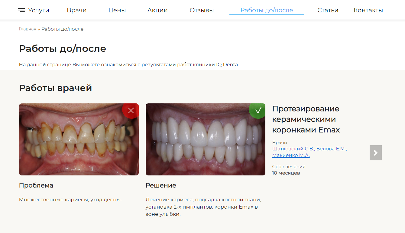 Раздел с фото до/после на сайте iqdenta.ru